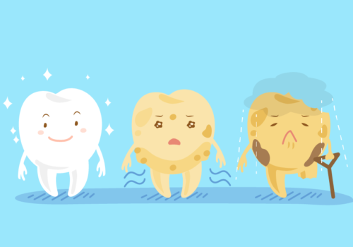 Learn the Five Stages of Dental Decay
