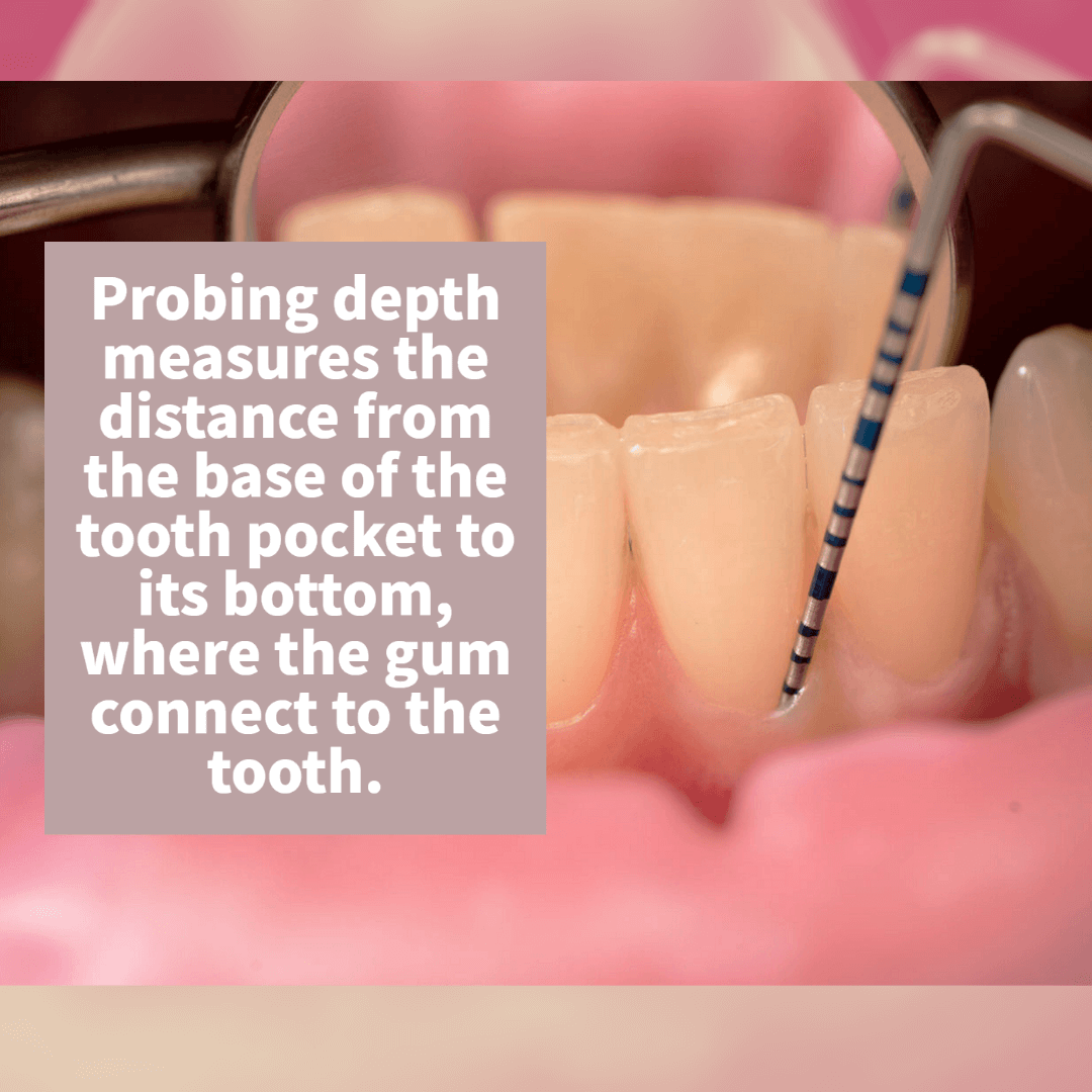 Probing Depth