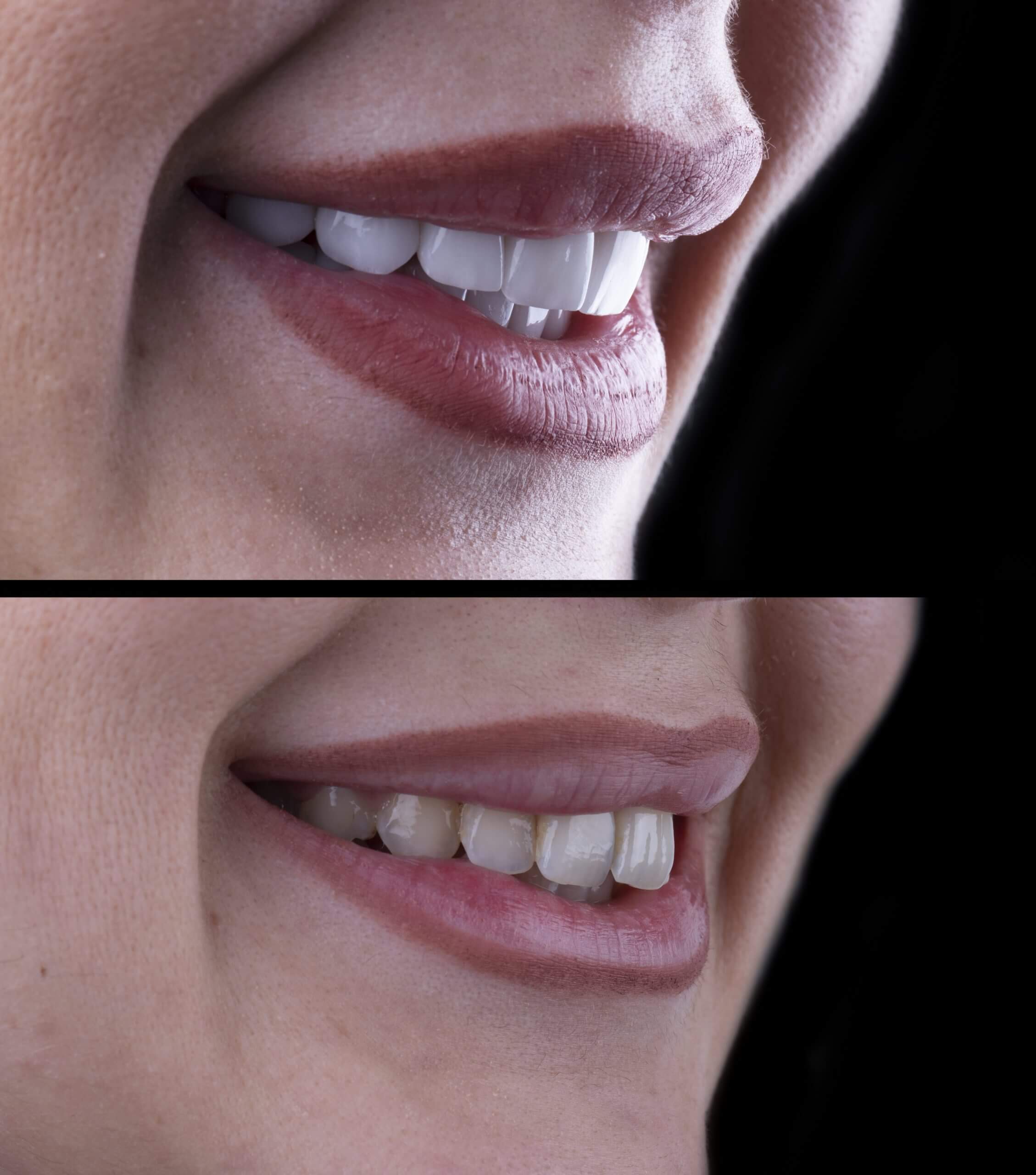 healthy smile at hale dentistry