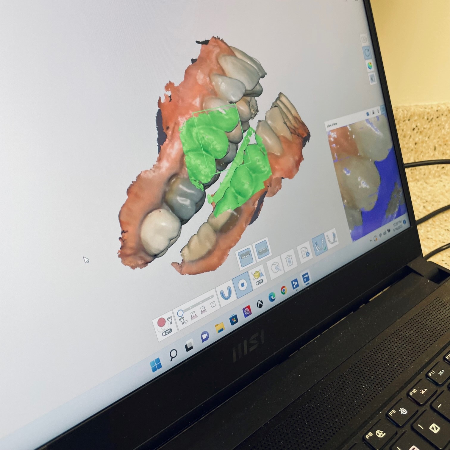 Dental Lab 3D Imaging for Crowns