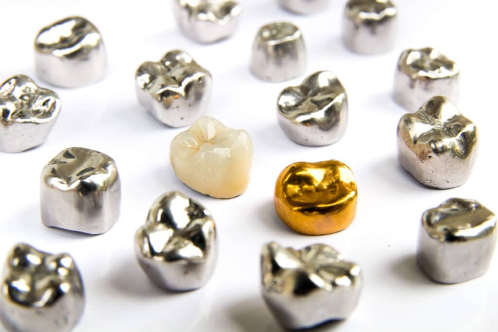 types of dental crown materials